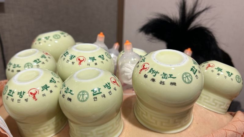 두한증 수족냉증 부항 치료 준비, 등에 부항컵을 올리는 장면