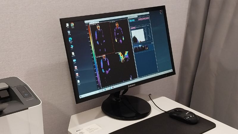 수족냉증 체열검사 DITI, 위아래 온도차를 눈으로 확인합니다